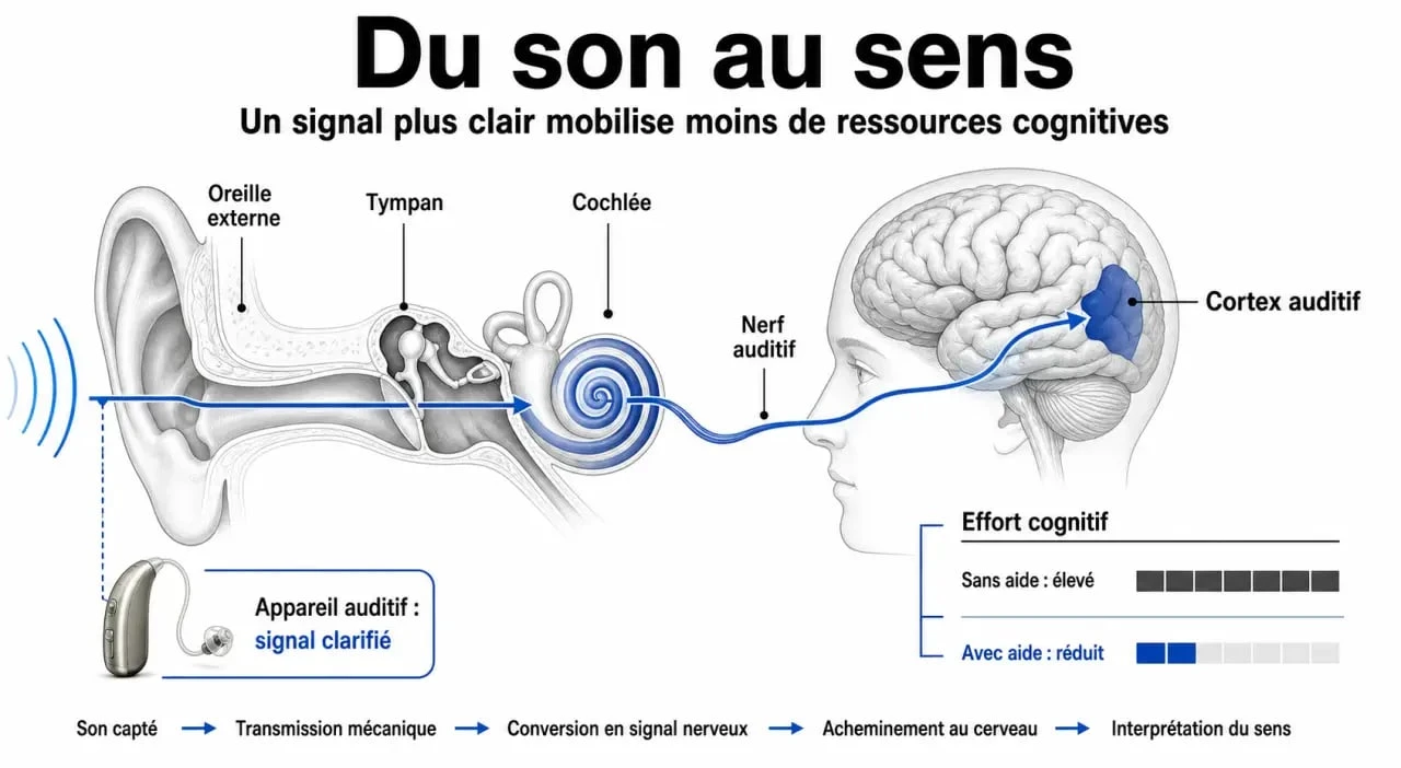 Appareil auditif et cerveau : schéma du trajet du son vers le cortex auditif et de la réduction de l’effort cognitif